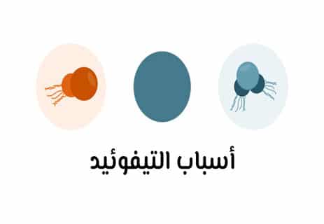 التيفوئيد يبدأ بهدوء… ثم يتحول إلى خطر 11 حمى نظيرة التيفوئيد