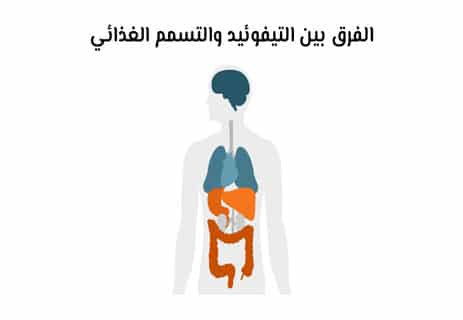 التيفوئيد يبدأ بهدوء… ثم يتحول إلى خطر 14 التيفوئيد والماء الملوث