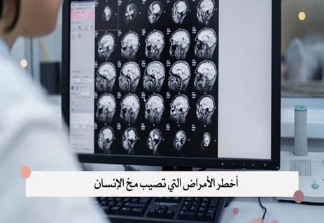 معلومات عن مخ الإنسان ستغير نظرتك إلى العقل البشري 14 أسرار الدماغ البشري