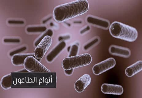 أسباب مرض الطاعون