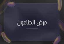 مرض الطاعون
