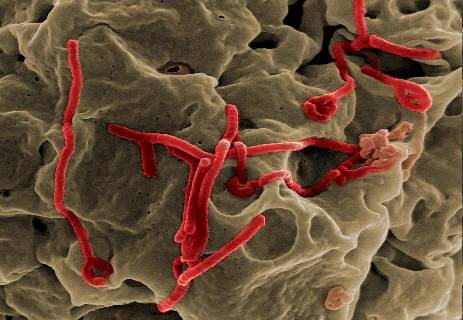 علاج فيروس إيبولا؛ لقاحات إيبولا؛ كيفية انتقال مرض الإيبولا
