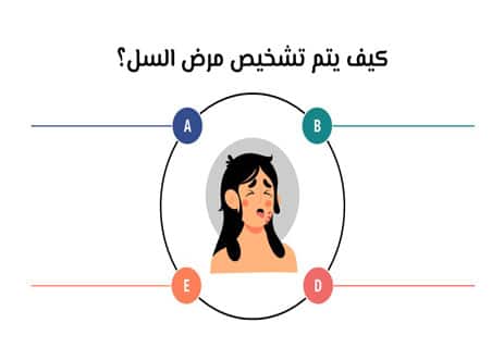 مرض السل (Tuberculosis): دليل شامل للأعراض والعلاج والوقاية 13 تحليل السل