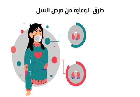 مرض السل (Tuberculosis): دليل شامل للأعراض والعلاج والوقاية 14 الوقاية من مرض السل