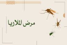 مرض الملاريا