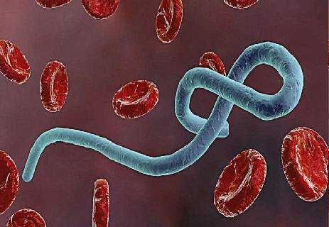 أعراض فيروس إيبولا؛ معلومات عن فيروس إيبولا؛ علاج فيروس إيبولا