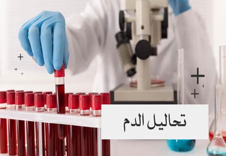 مكونات دم الإنسان: رحلة داخل شرايين الحياة 13 أهم تحاليل الدم