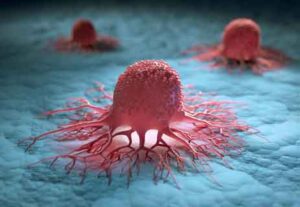 Read more about the article كيف تتمرد الخلايا السرطانية لتنتشر في جميع أجزاء الجسم؟