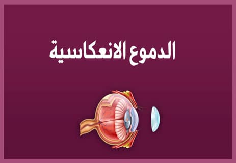 أنواع الدموع